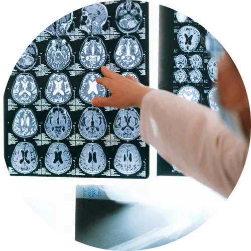 doctor looking at images of a brain scan, Traumatic Brain Injury Lawyers Atlanta GA