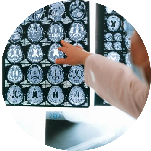Lawyers in Rockdale, GA-doctor looking at images of a brain scan, Traumatic Brain Injury 
