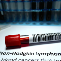 Non-Hodgkin's Lymphoma